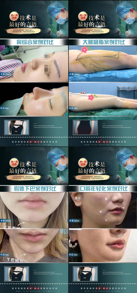 源文件下载【整形医生案例海报】编号：12260020681765463