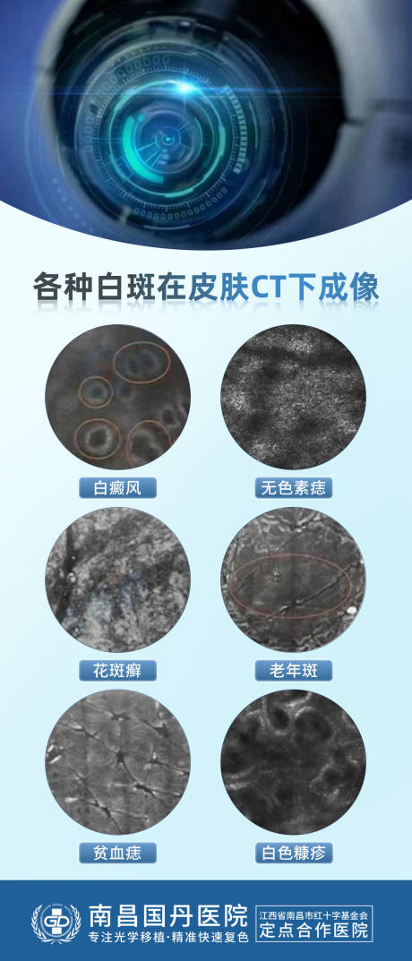 源文件下载【白癜风案例海报】编号：75990020375477921