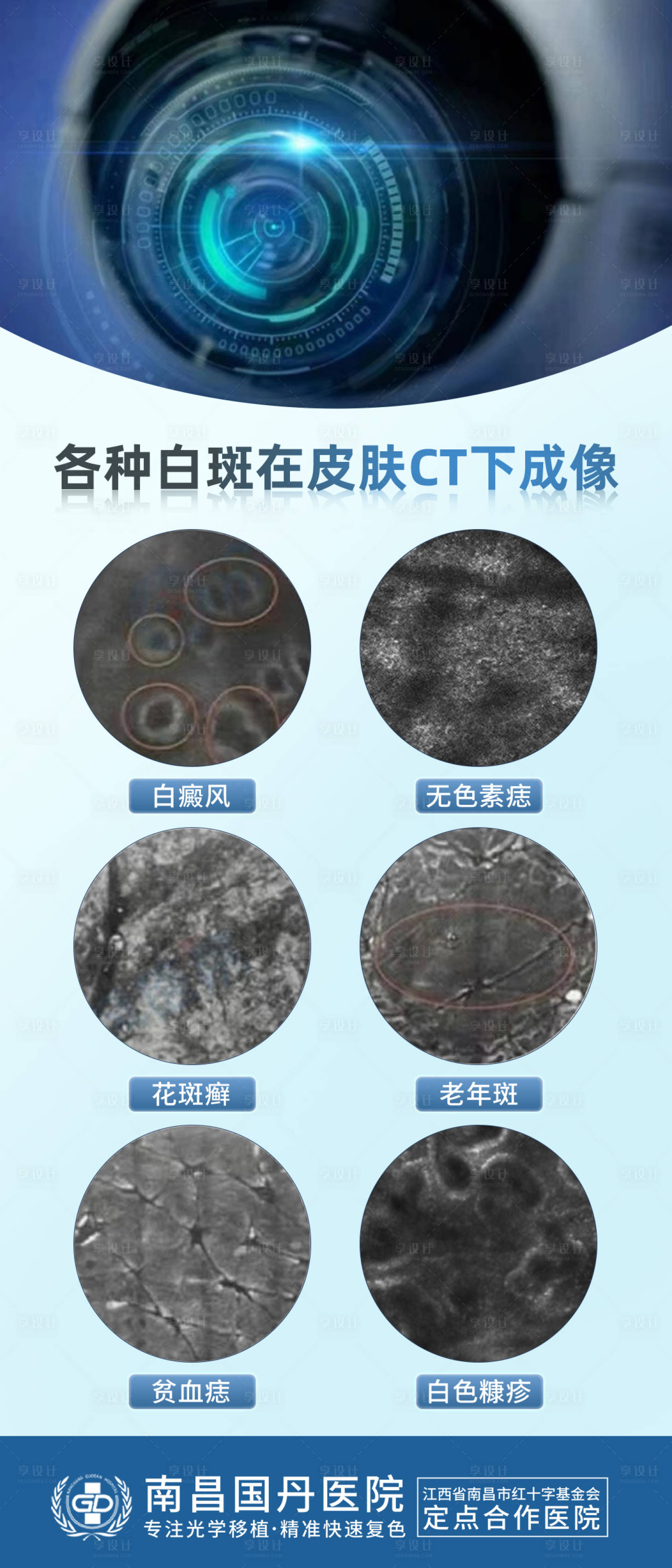 源文件下載【享設(shè)計(jì)】搜索編號(hào)：75990020375477921【白癜風(fēng)案例海報(bào)】