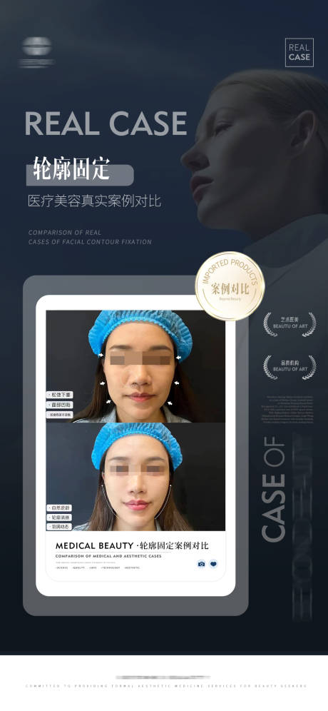 源文件下载【医美案例海报 】编号：29950020389602554