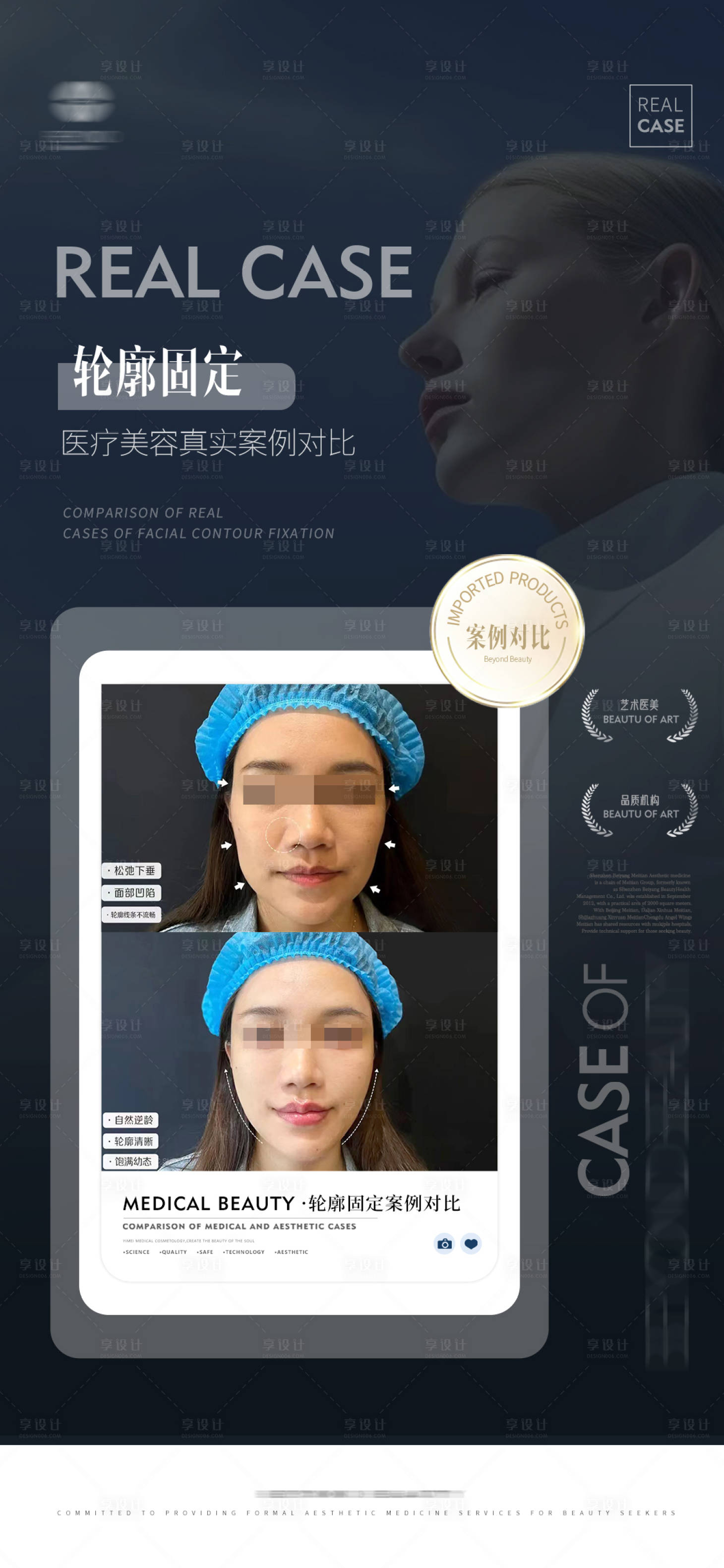 源文件下载【医美案例海报 】编号：29950020389602554