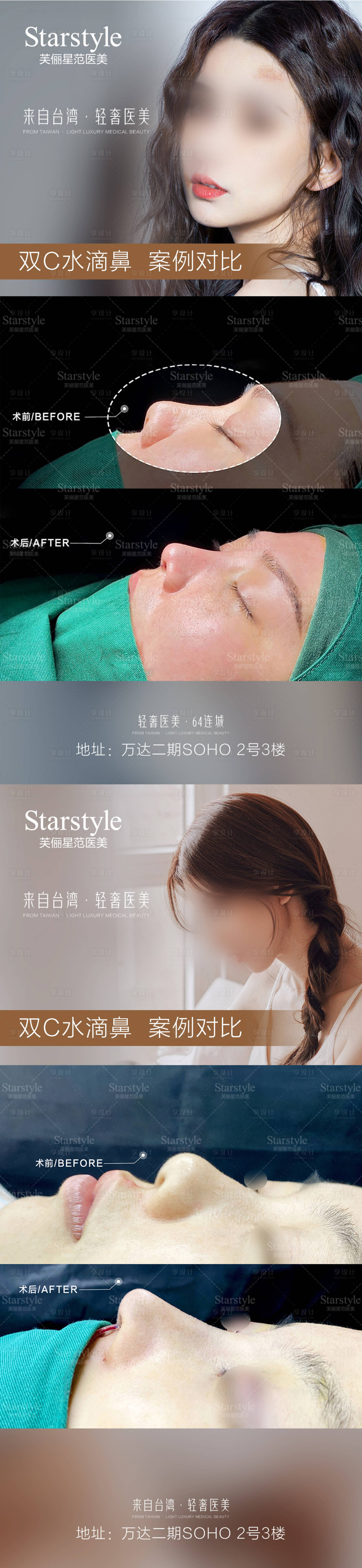 源文件下载【享设计】搜索编号：49860020690472356【医美鼻子案例对比】