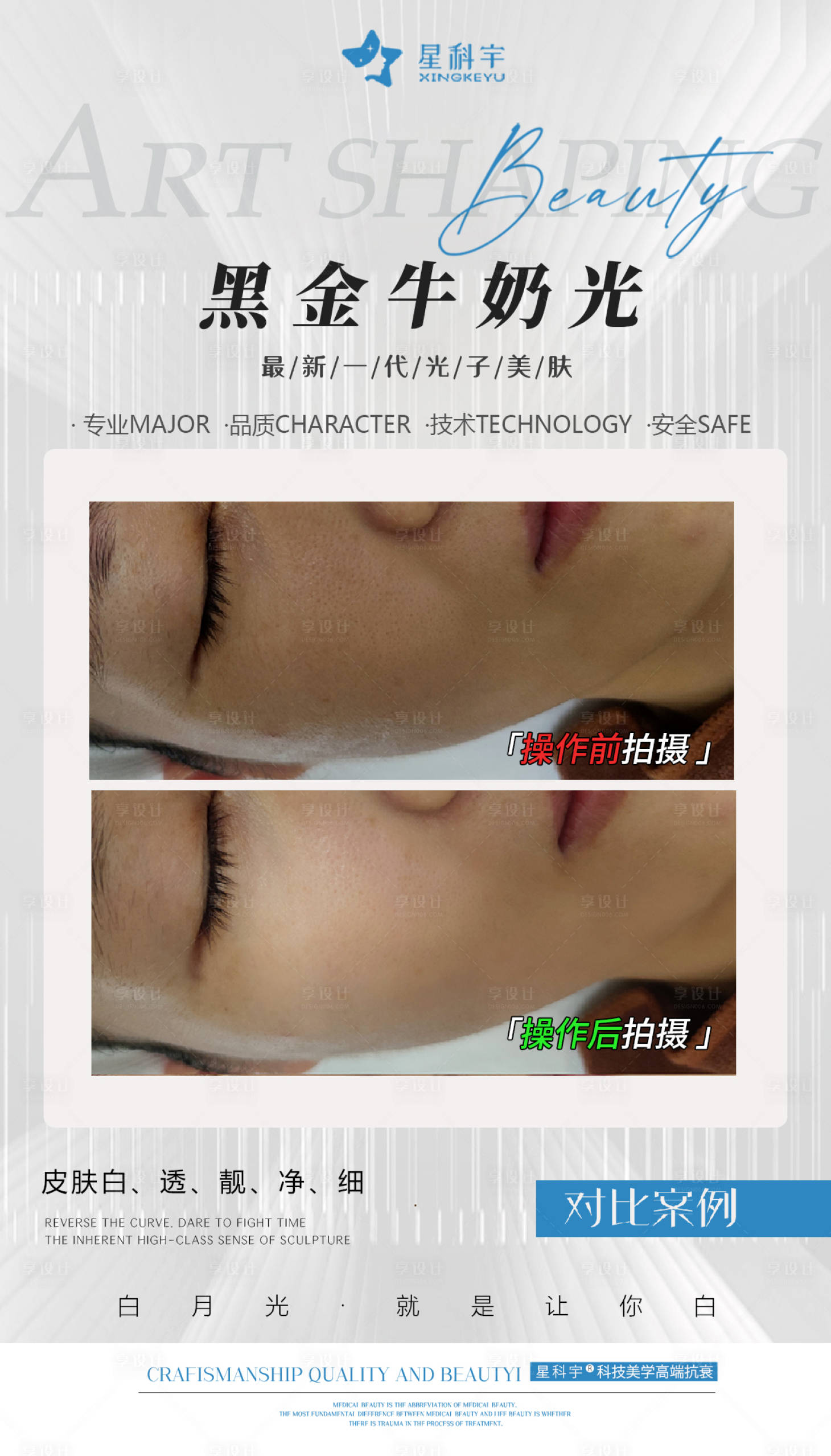 源文件下載【享設計】搜索編號：94720020611957391【對比圖】