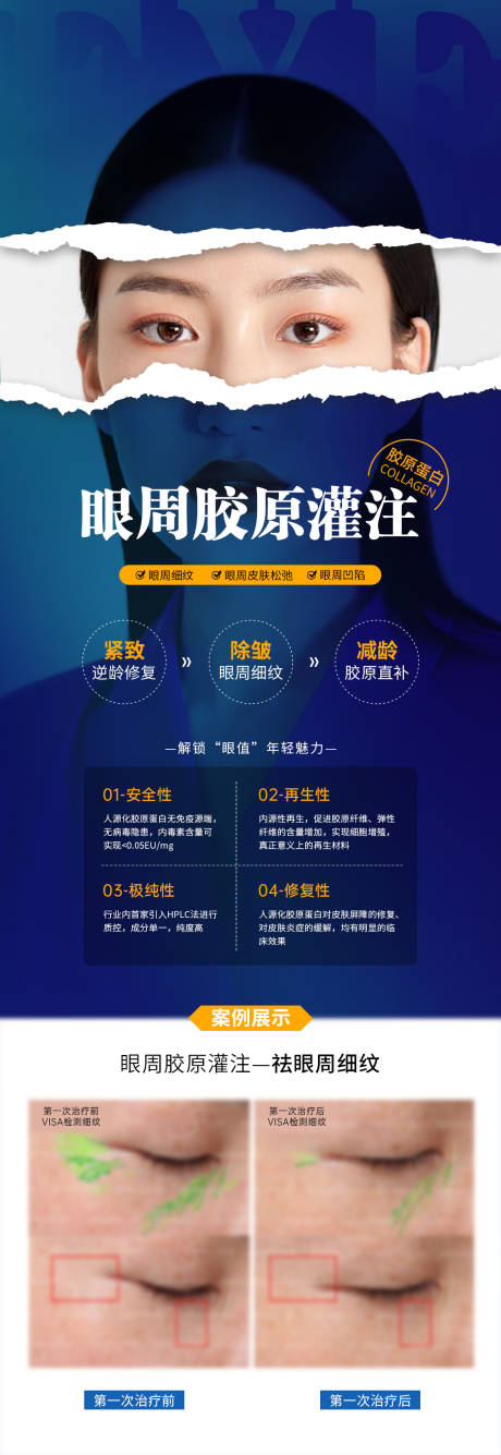 源文件下载【医美眼周胶原灌注案例海报】编号：20231109104506795