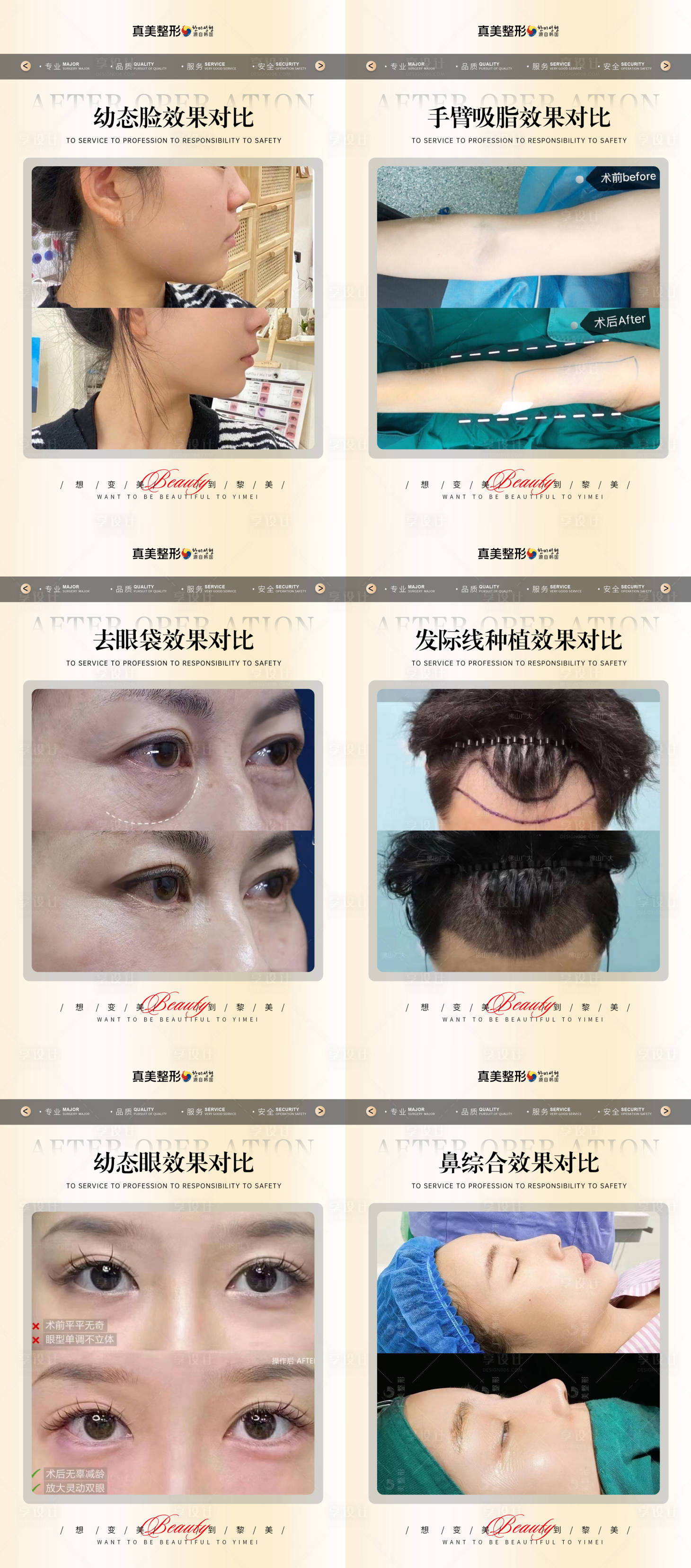 源文件下载【医美案例对比海报】编号：52320020637098133