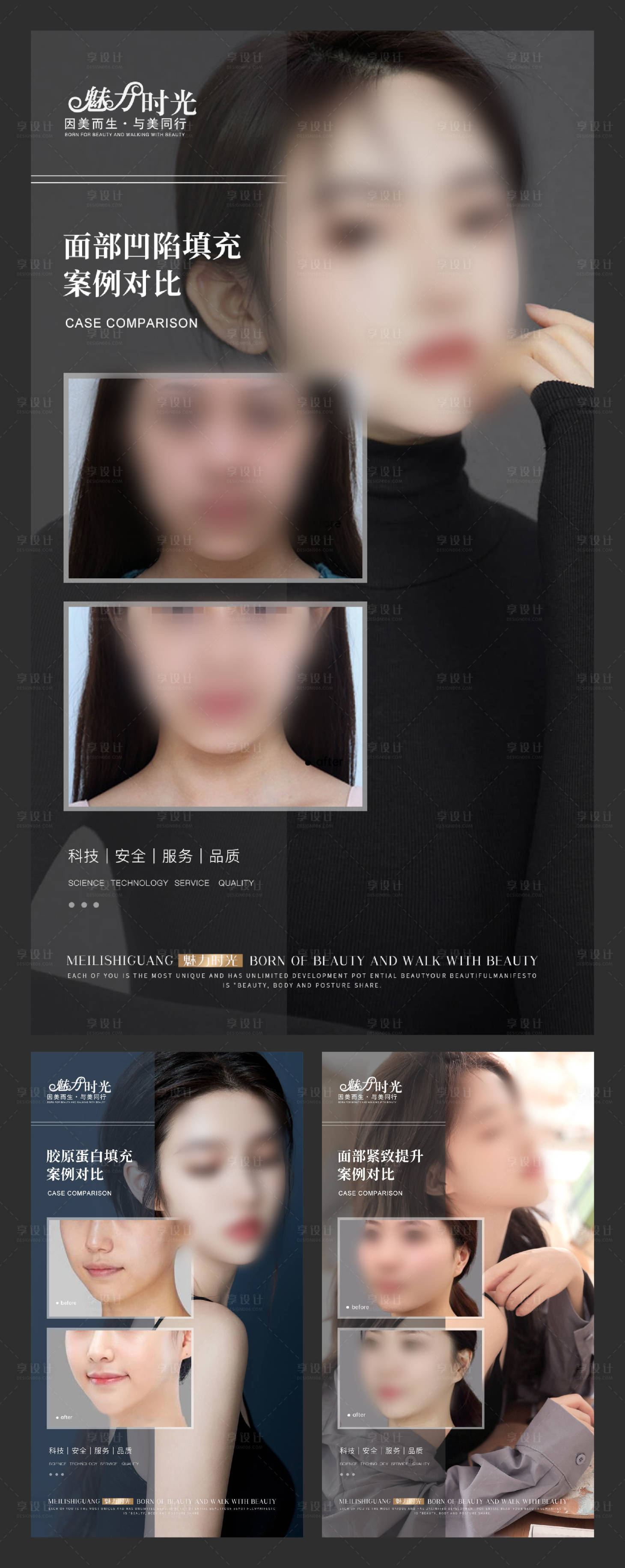 源文件下載【享設計】搜索編號：41070020329501124【醫美面部案例海報】