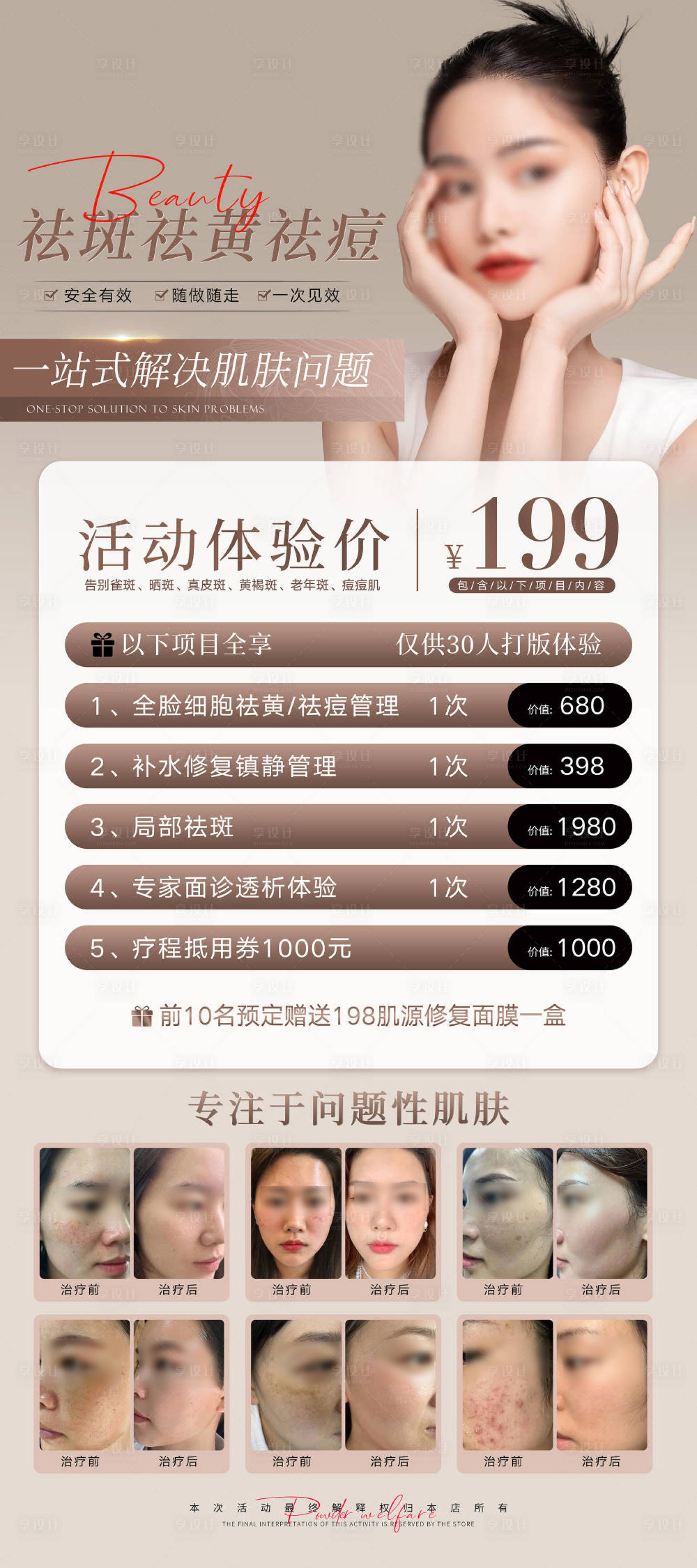 源文件下载【祛斑皮肤管理活动展架 】编号：67420020675019337