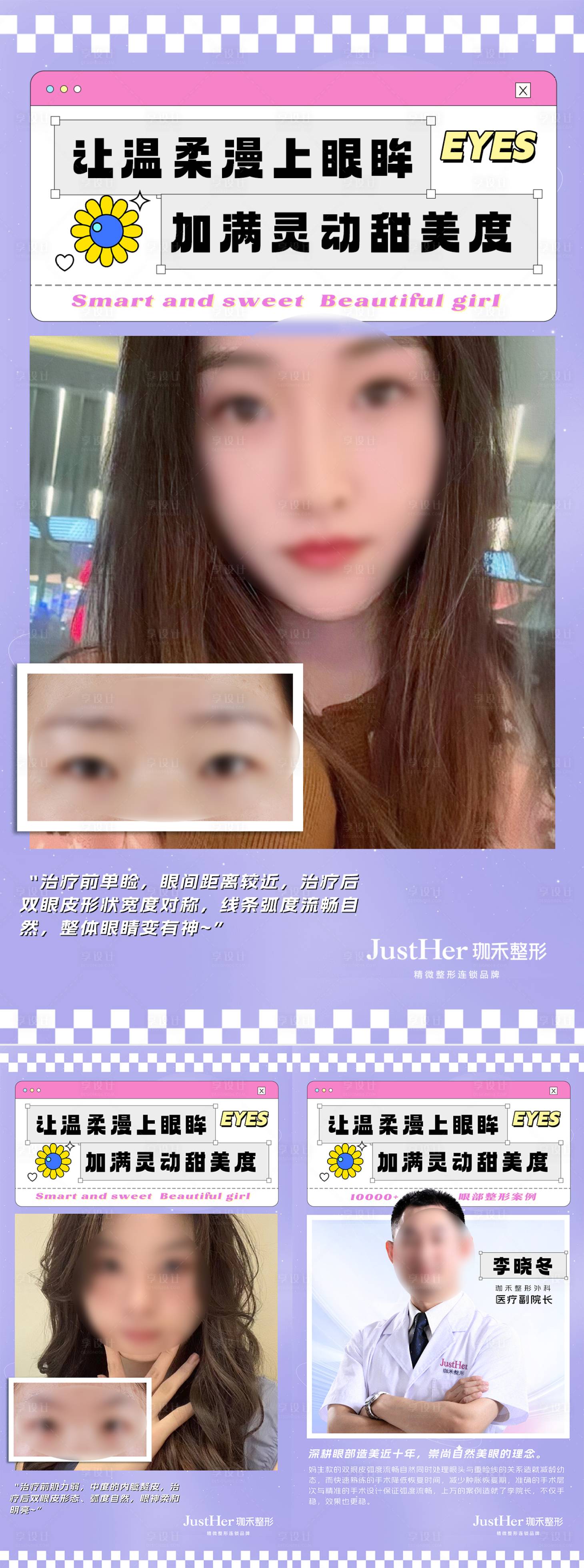 源文件下载【享设计】搜索编号：70860020276276030【双眼皮案例对比海报】