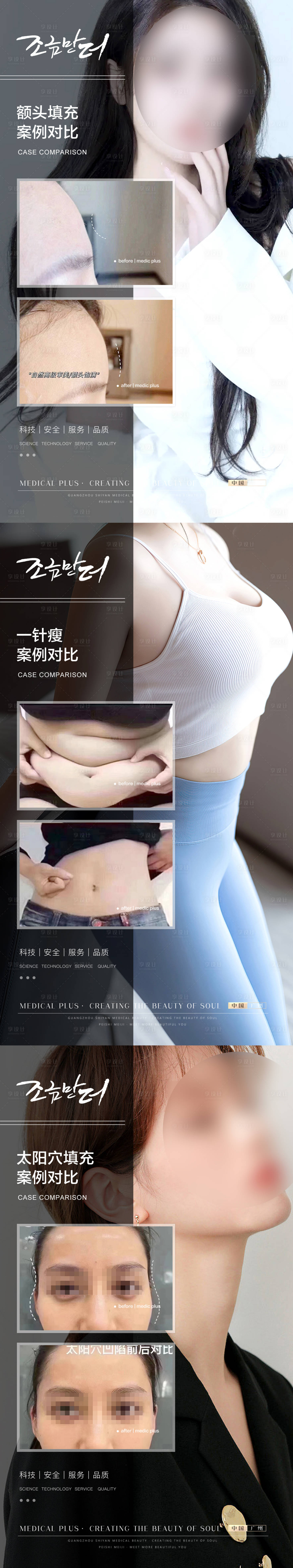 源文件下載【醫(yī)美案例對比模板海報】編號：58120021090299162