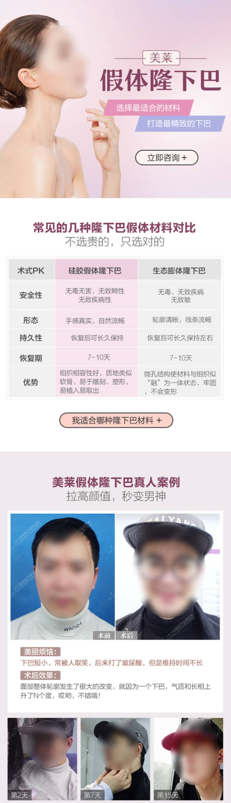 源文件下载【医美假体隆下巴详情页】编号：54900020824749808
