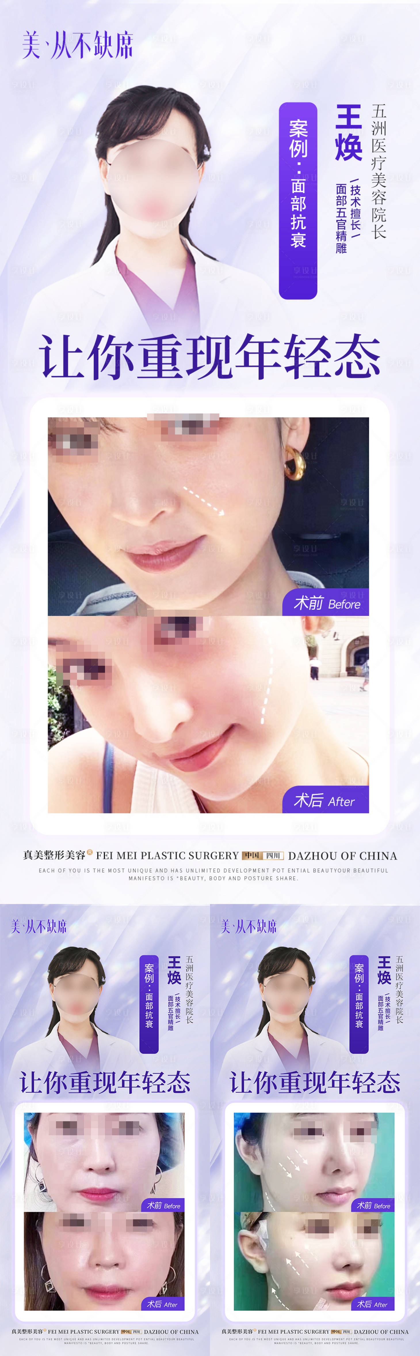 源文件下載【醫(yī)生案例抗衰海報(bào)】編號(hào)：90670020836064534