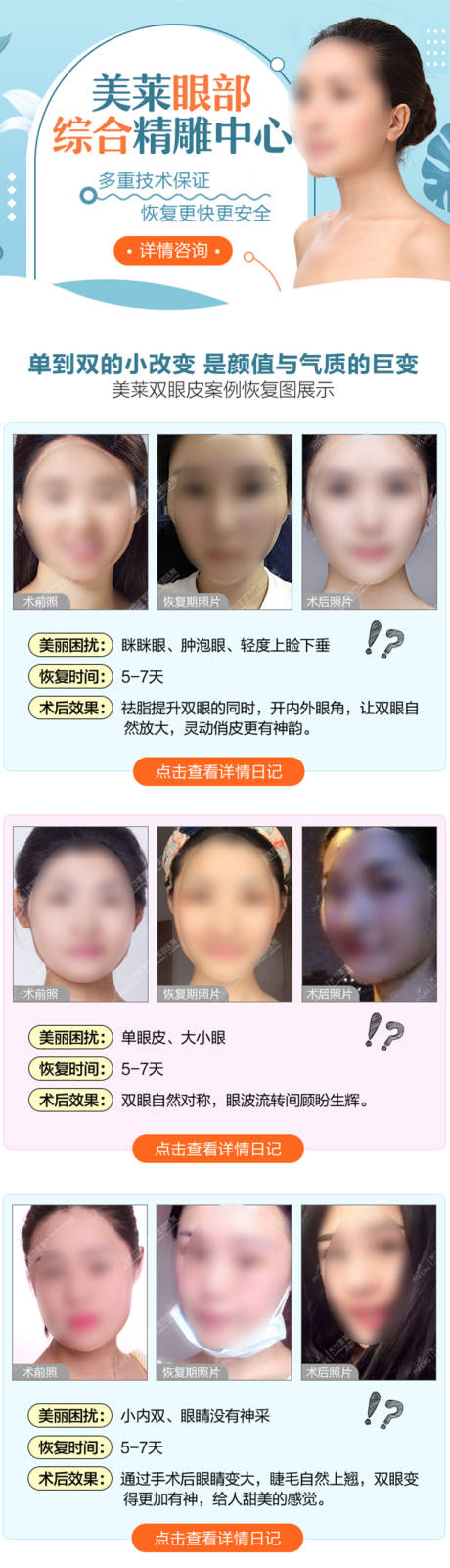 源文件下載【享設(shè)計】搜索編號：96490020723186784【醫(yī)美雙眼皮詳情頁】