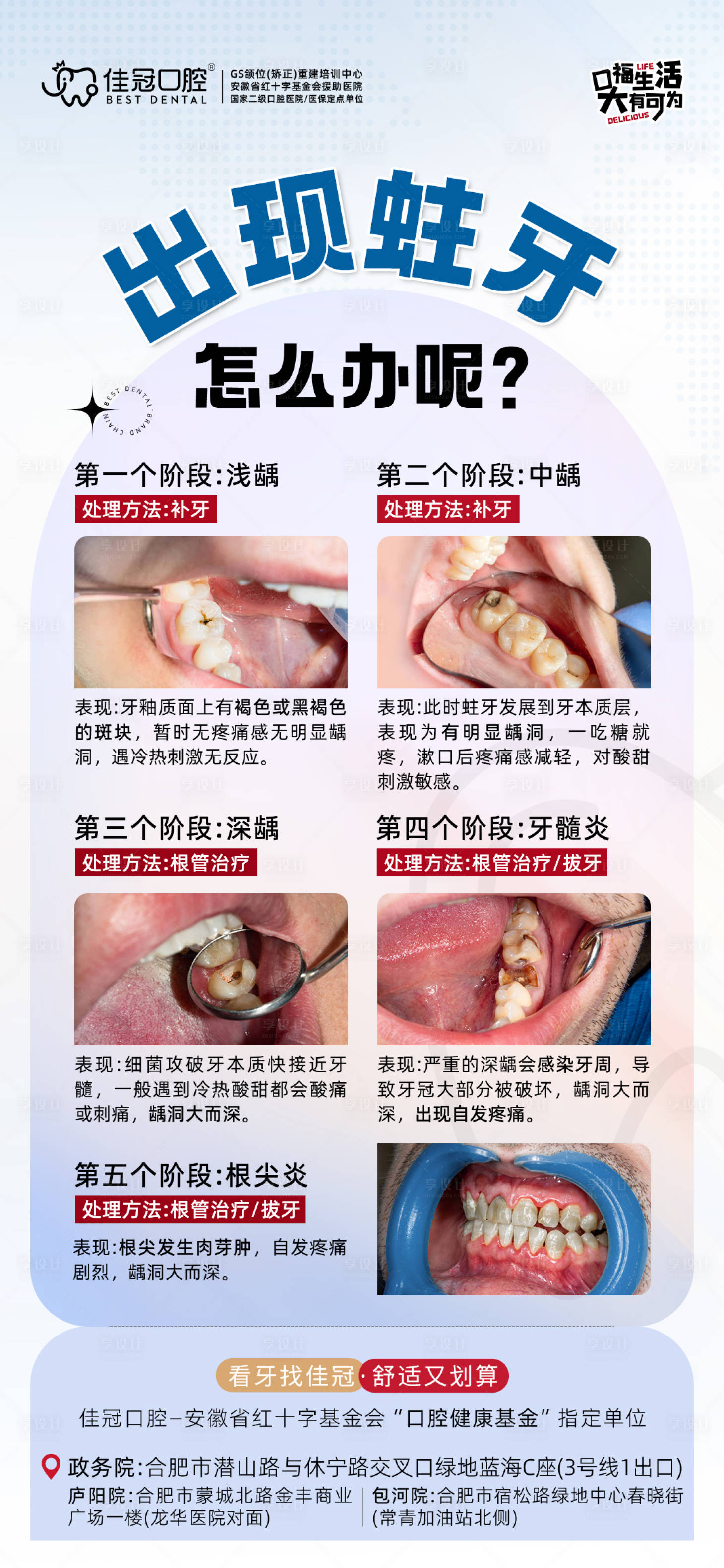 源文件下载【蛀牙海报】编号：20760020977242622