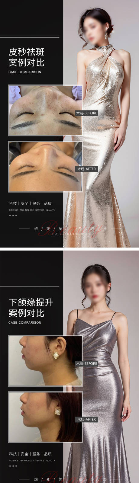 源文件下载【享设计】搜索编号：65520021248807837【医美案例对比海报】