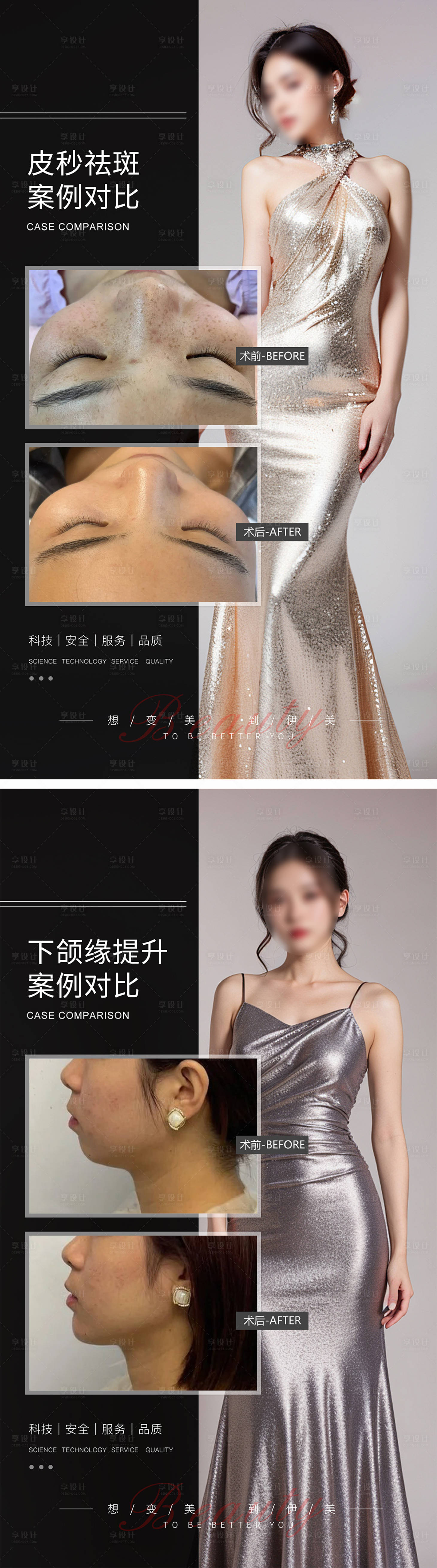 源文件下載【享設計】搜索編號：65520021248807837【醫美案例對比海報】