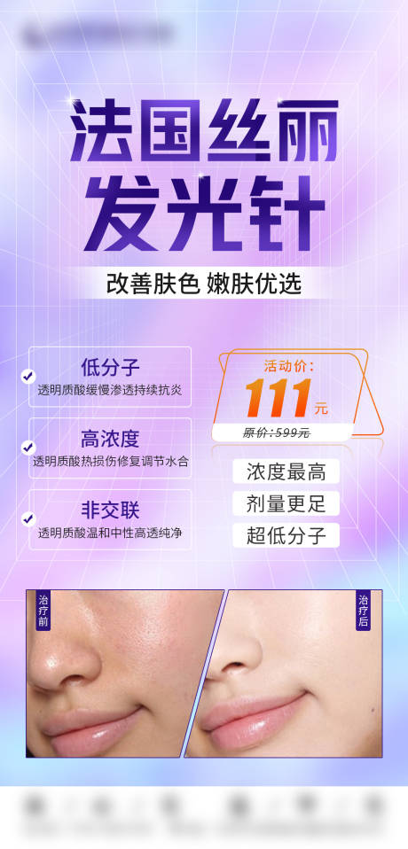 源文件下载【法国丝丽发光针】编号：80370020957166733