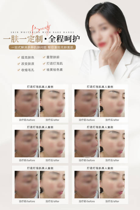 源文件下载【享设计】搜索编号：94780021006153253【医美案例海报】