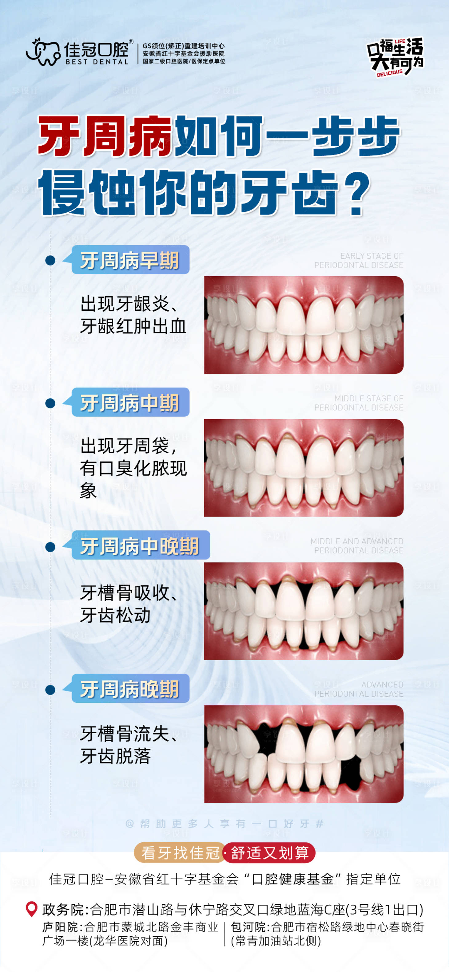 源文件下載【享設計】搜索編號：40030020977267618【牙周病科普海報】