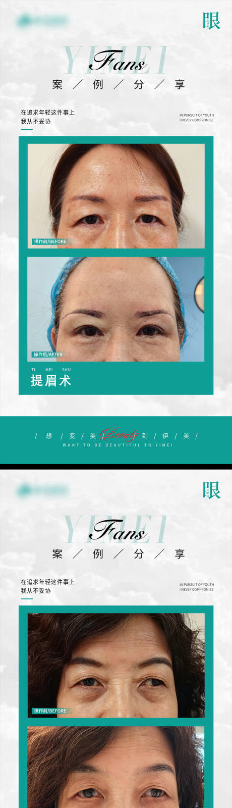 源文件下载【医美案例模板对比】编号：67760020733296502