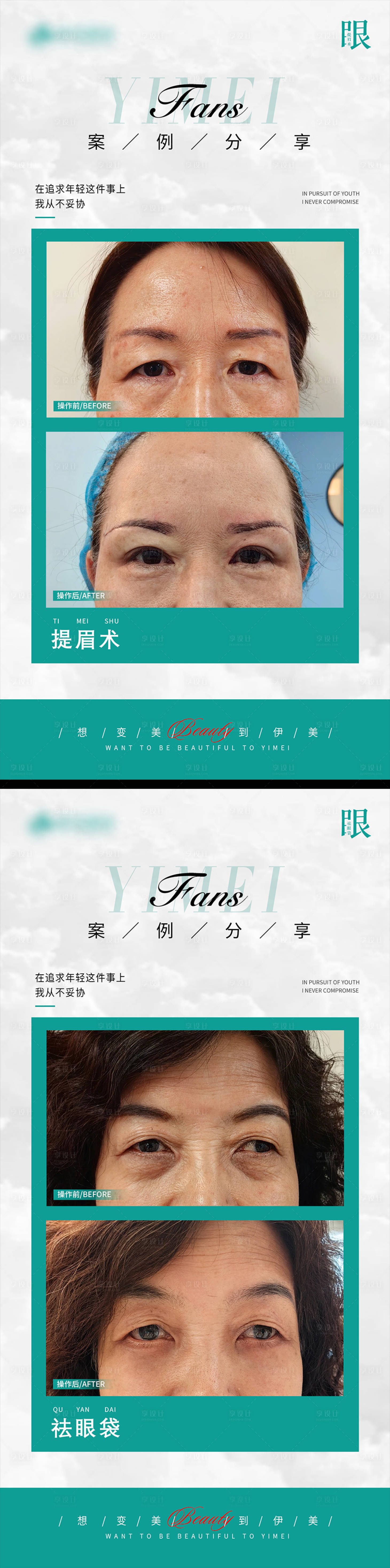 源文件下载【享设计】搜索编号：67760020733296502【医美案例模板对比】
