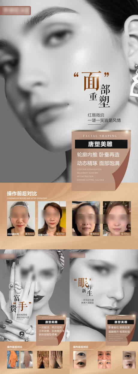 源文件下载【医美整形项目系列海报】编号：26710021210473587