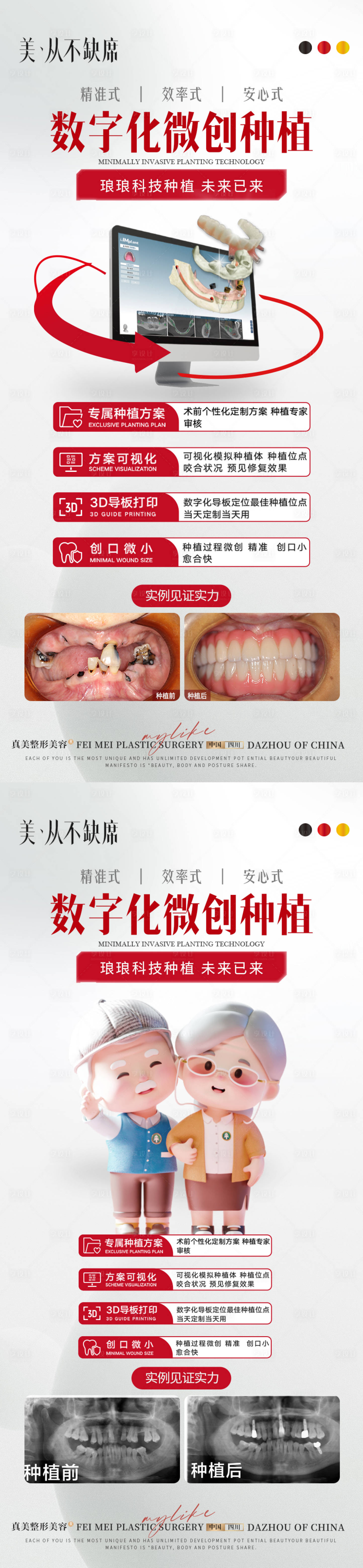 源文件下载【数字化种植技术案例】编号：16380021250088635