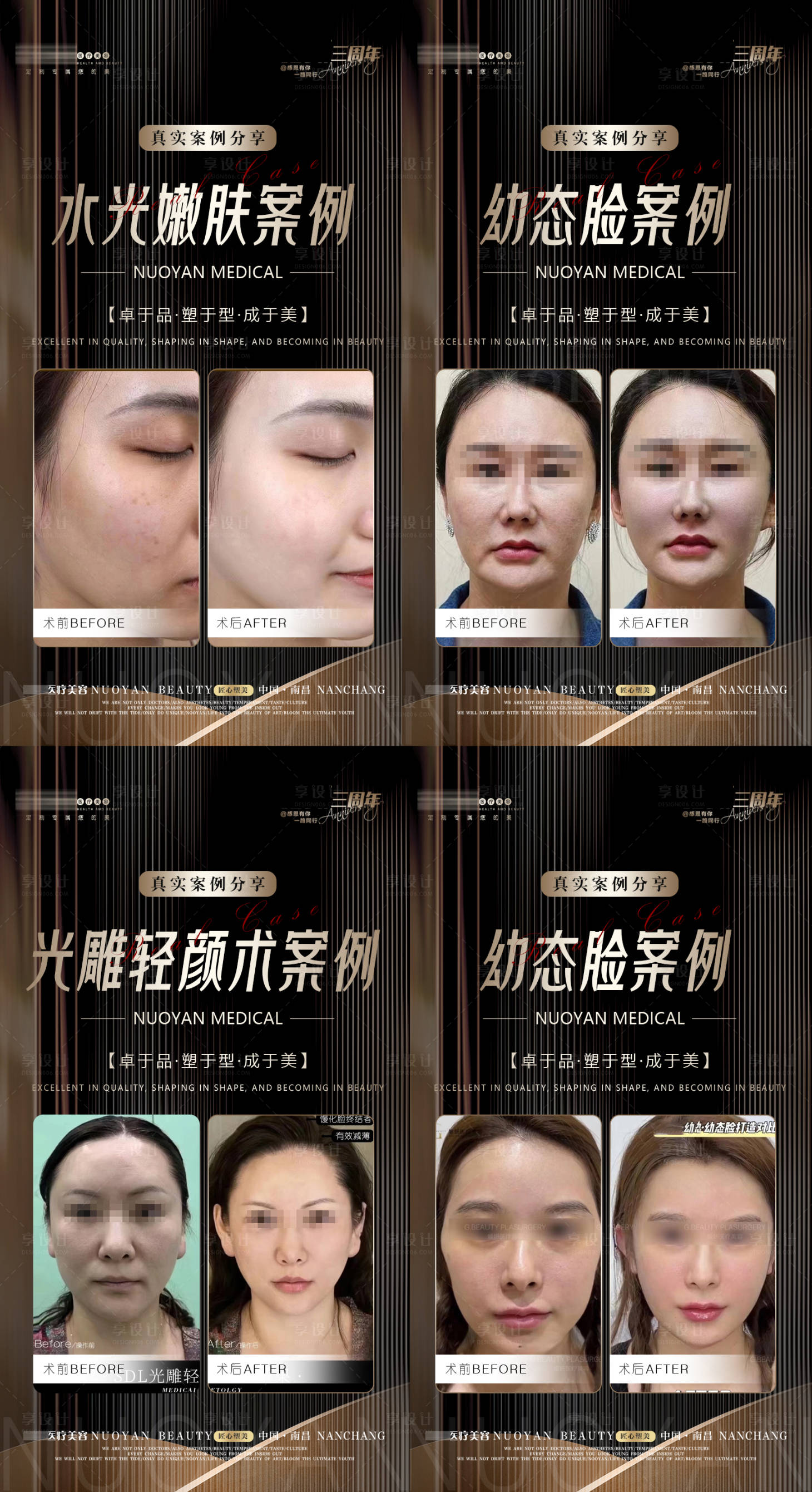 源文件下載【享設(shè)計(jì)】搜索編號：64000021122536223【醫(yī)美黑金案例海報(bào)】