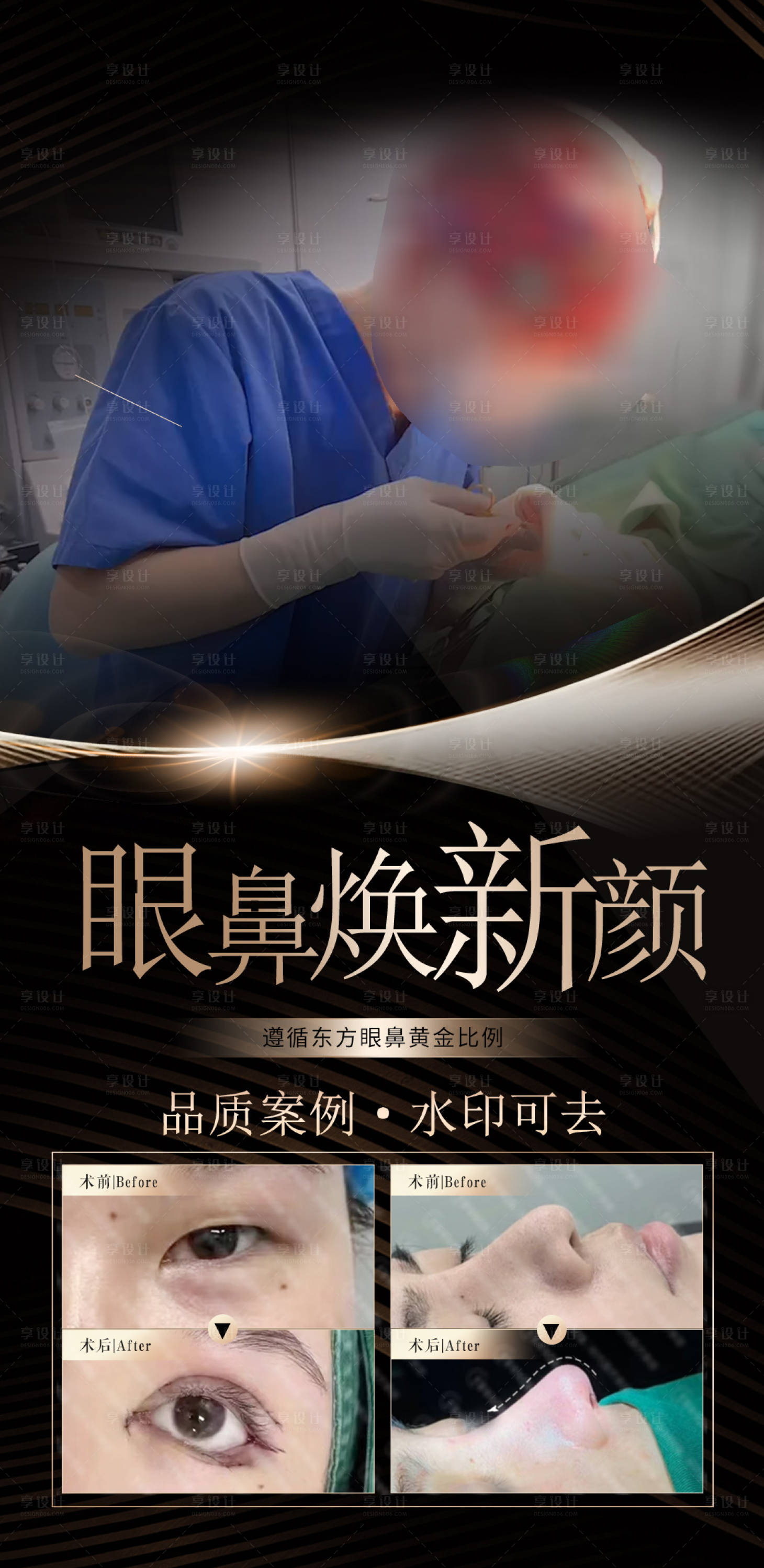 源文件下载【享设计】搜索编号：83010021207661666【眼鼻医美案例海报】