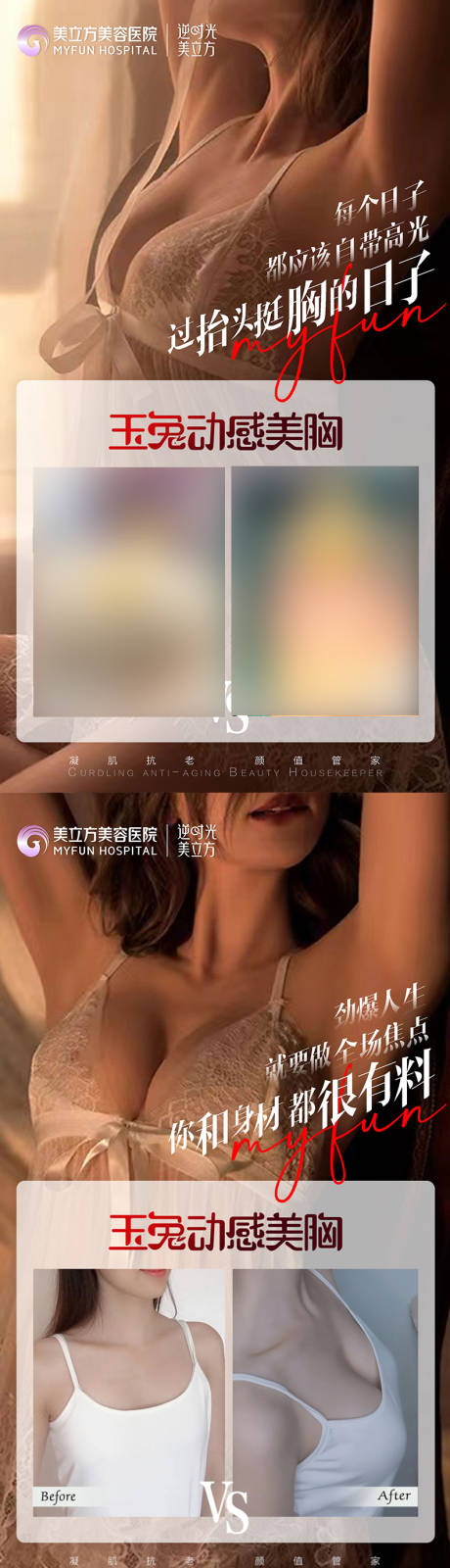 源文件下载【医美丰胸隆胸案例对比美女私密】编号：12810020734064030
