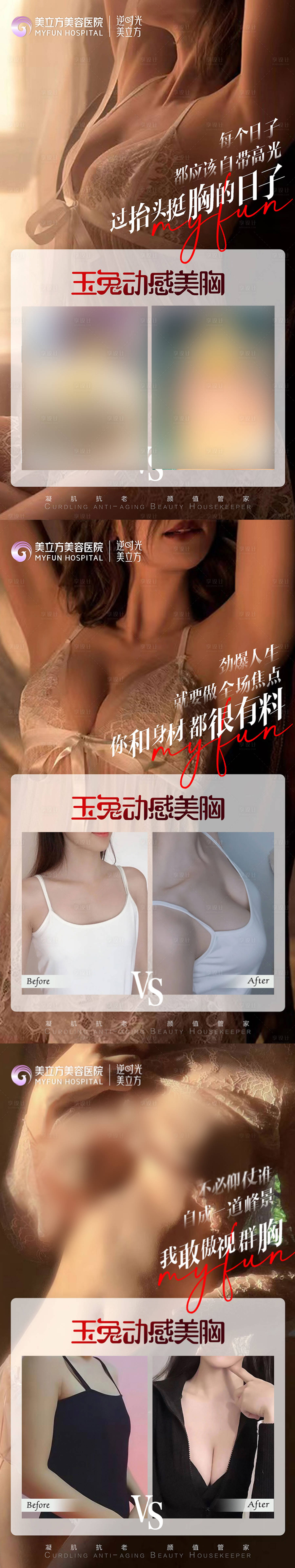 源文件下载【享设计】搜索编号：12810020734064030【医美丰胸隆胸案例对比美女私密】
