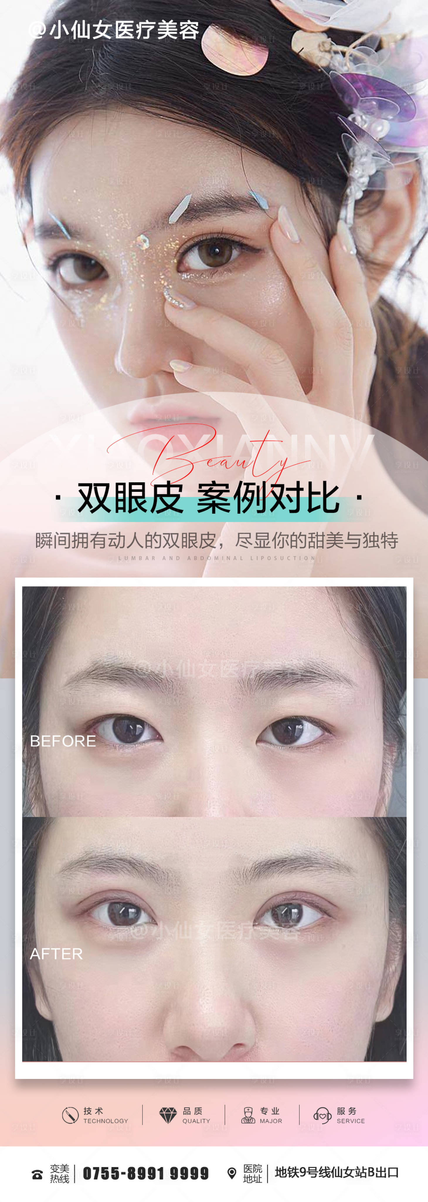 源文件下載【享設計】搜索編號：59630021139136367【整形醫(yī)美眼綜合案例長圖海報】