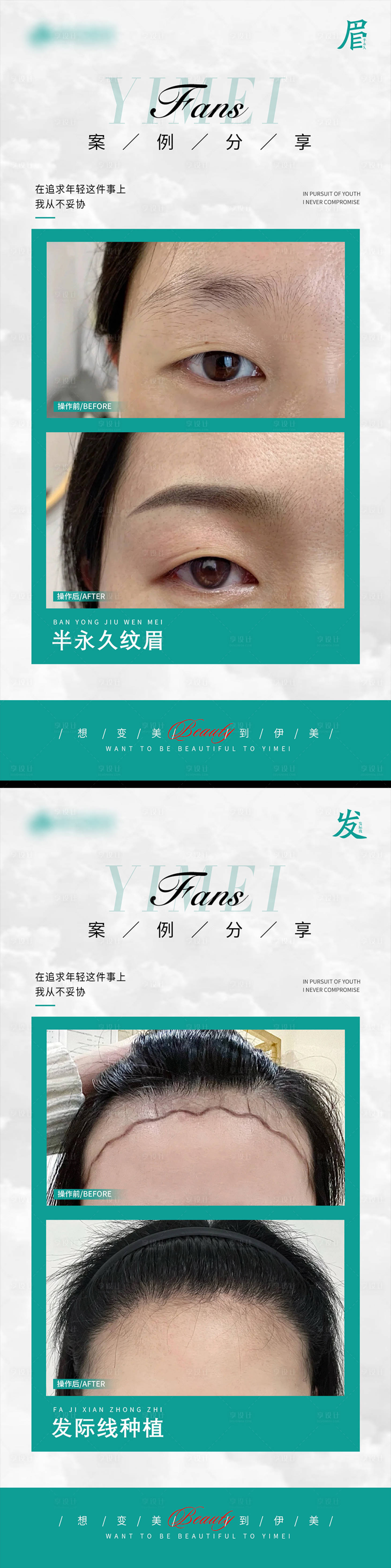 源文件下载【享设计】搜索编号：43390020983853564【医美案例对比模板海报】
