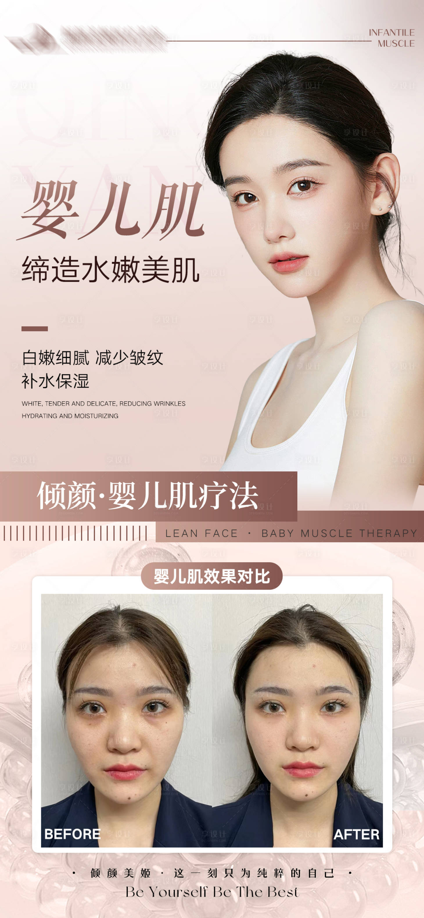 源文件下载【医美婴儿肌】编号：50550020942812313