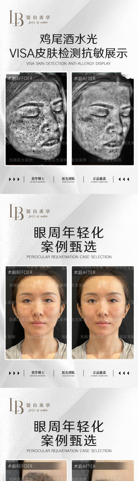源文件下载【医美案例对比图】编号：82980020848668565