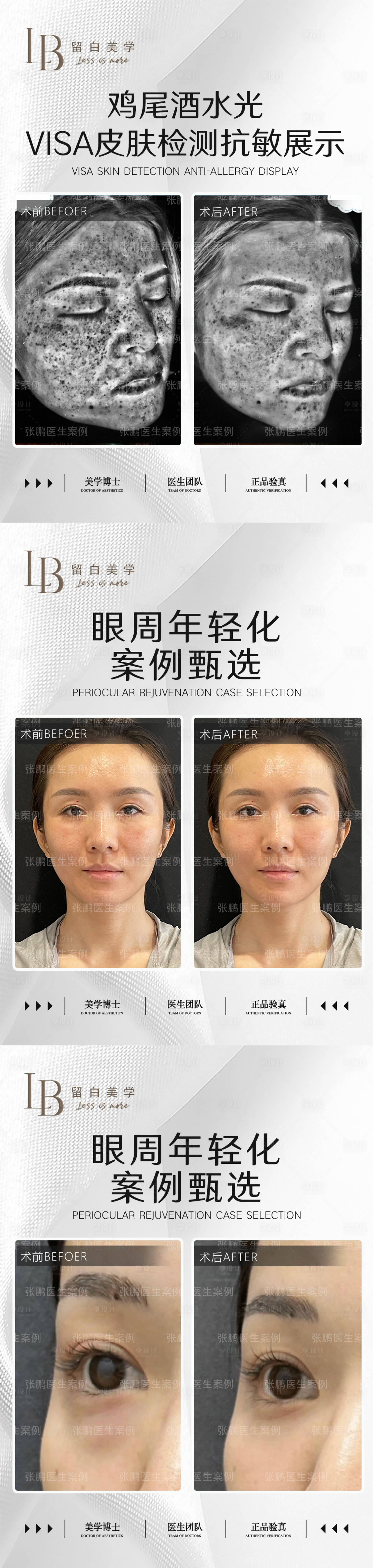 源文件下載【享設計】搜索編號：82980020848668565【醫美案例對比圖】