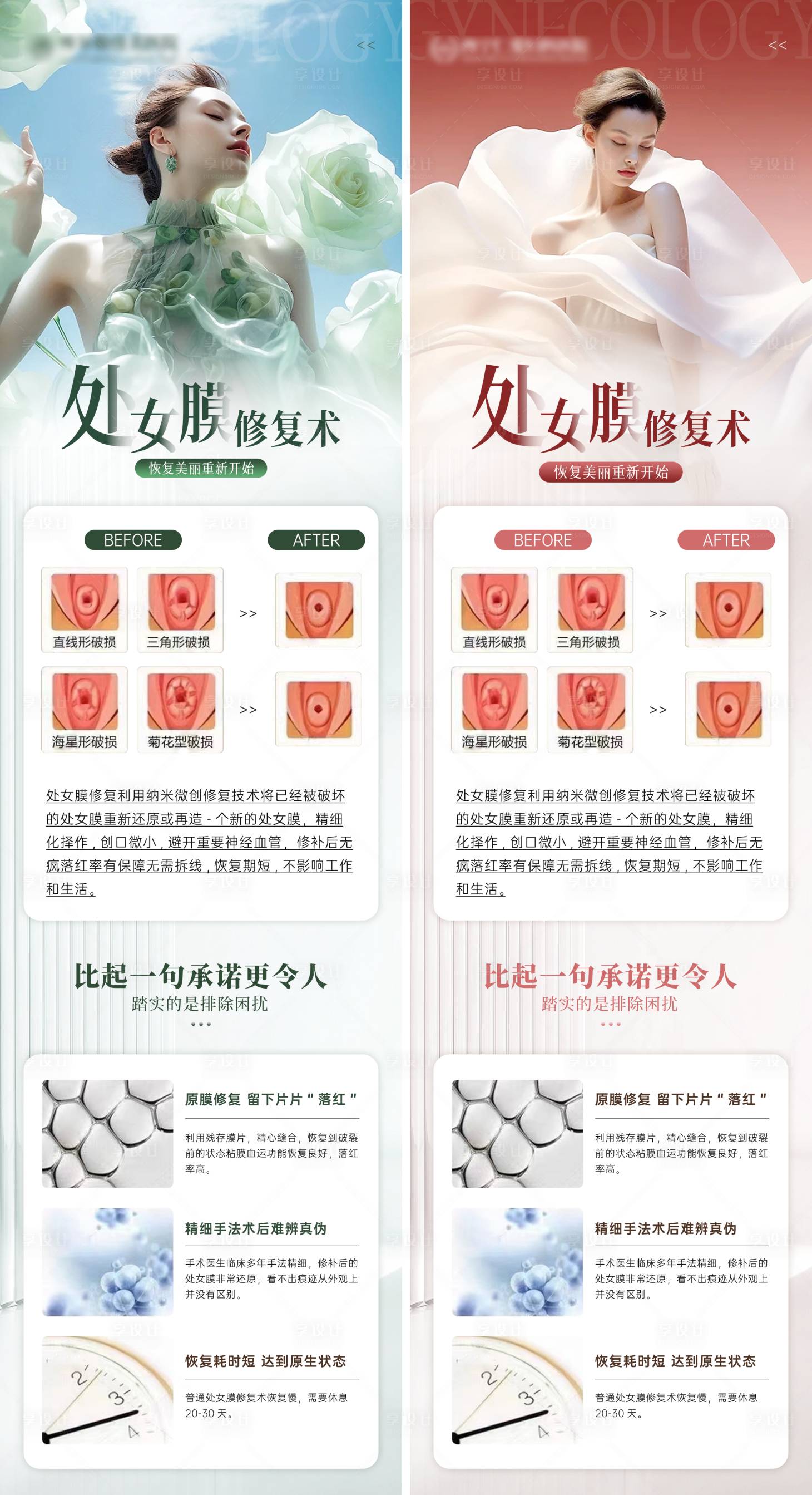 处女膜 处女膜修复术PSD广告设计素材海报模板免费下载-享设计