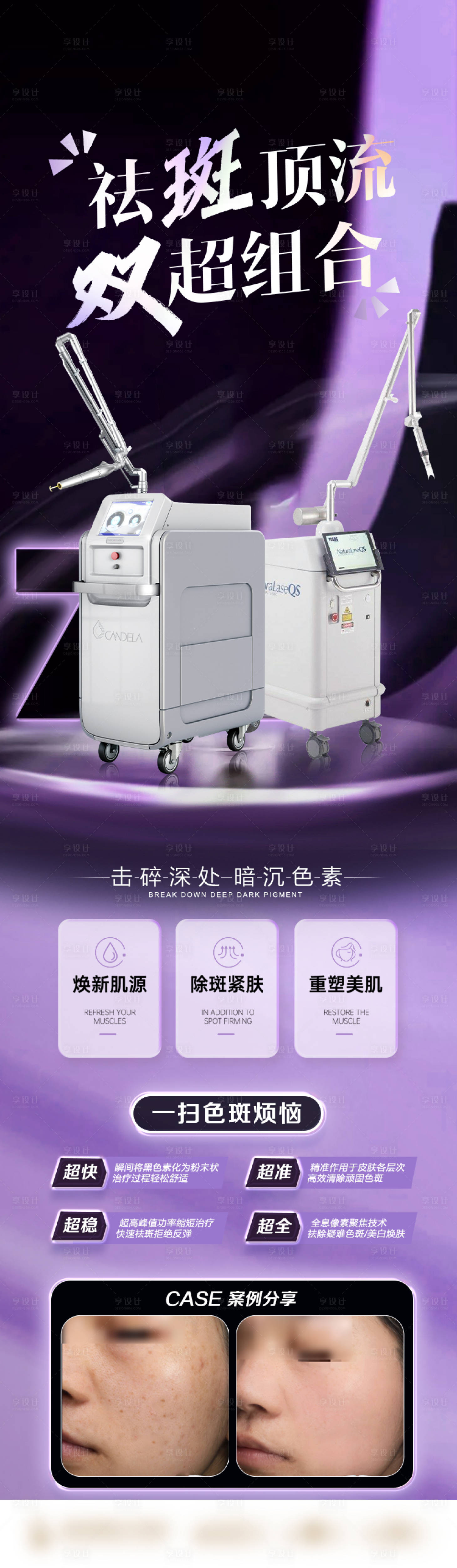 源文件下載【享設計】搜索編號：74190020855198406【醫美超皮秒儀器祛斑海報】