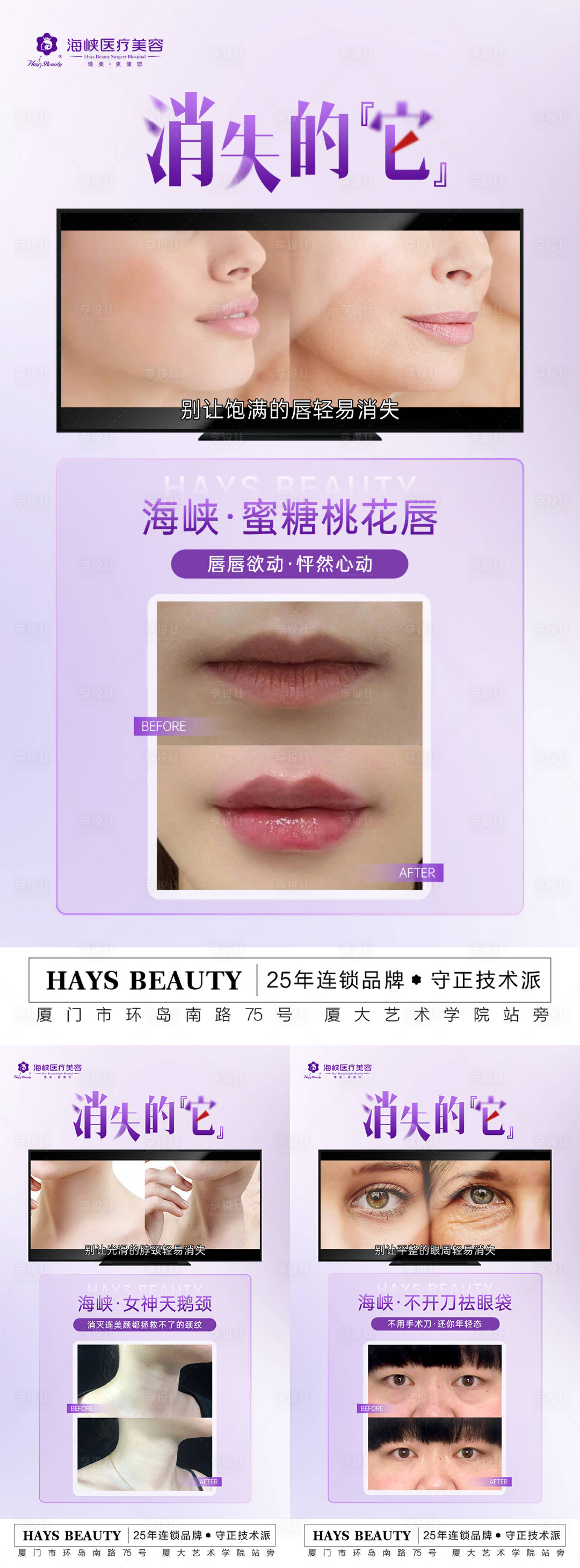 源文件下载【享设计】搜索编号：83130020750157065【丰唇祛颈纹祛眼袋海报】