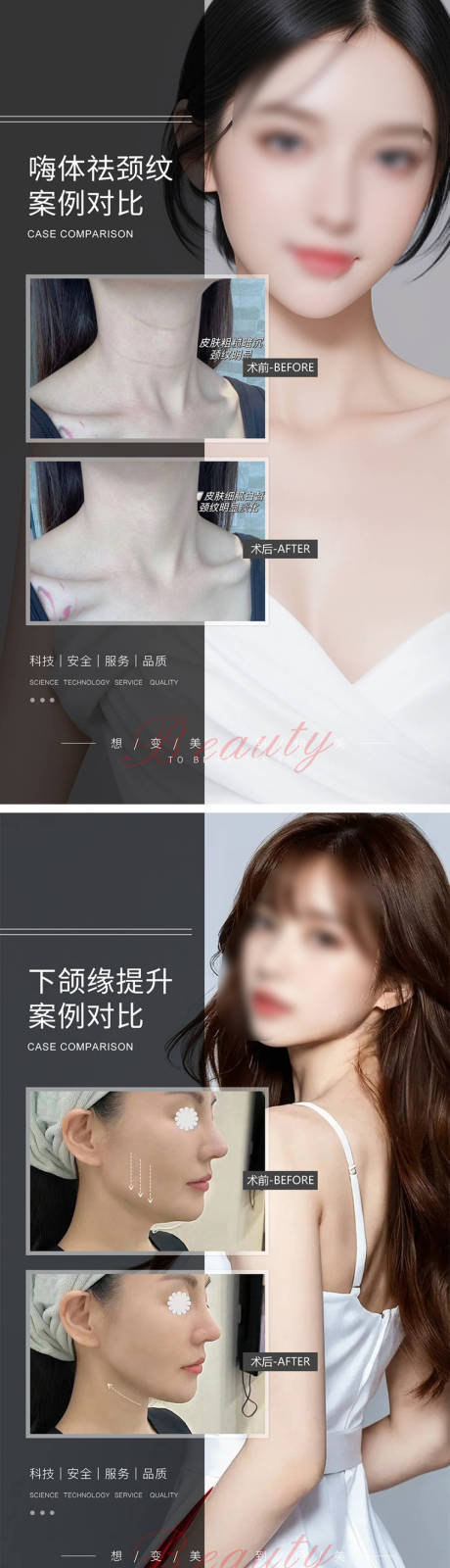 源文件下载【享设计】搜索编号：27860021087808420【医美案例对比海报】