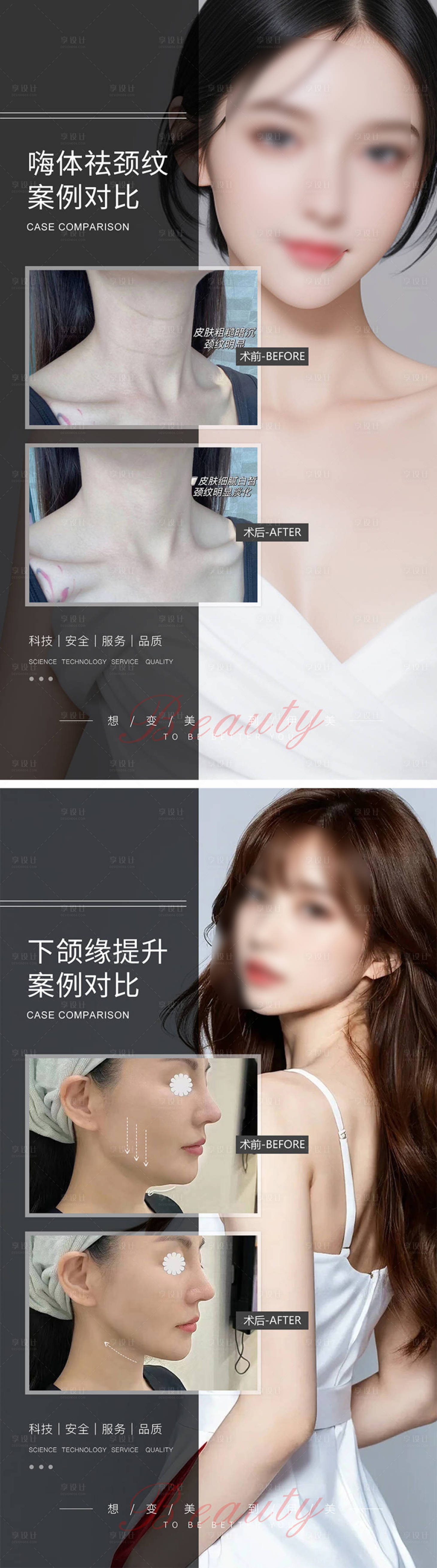 源文件下载【享设计】搜索编号：27860021087808420【医美案例对比海报】