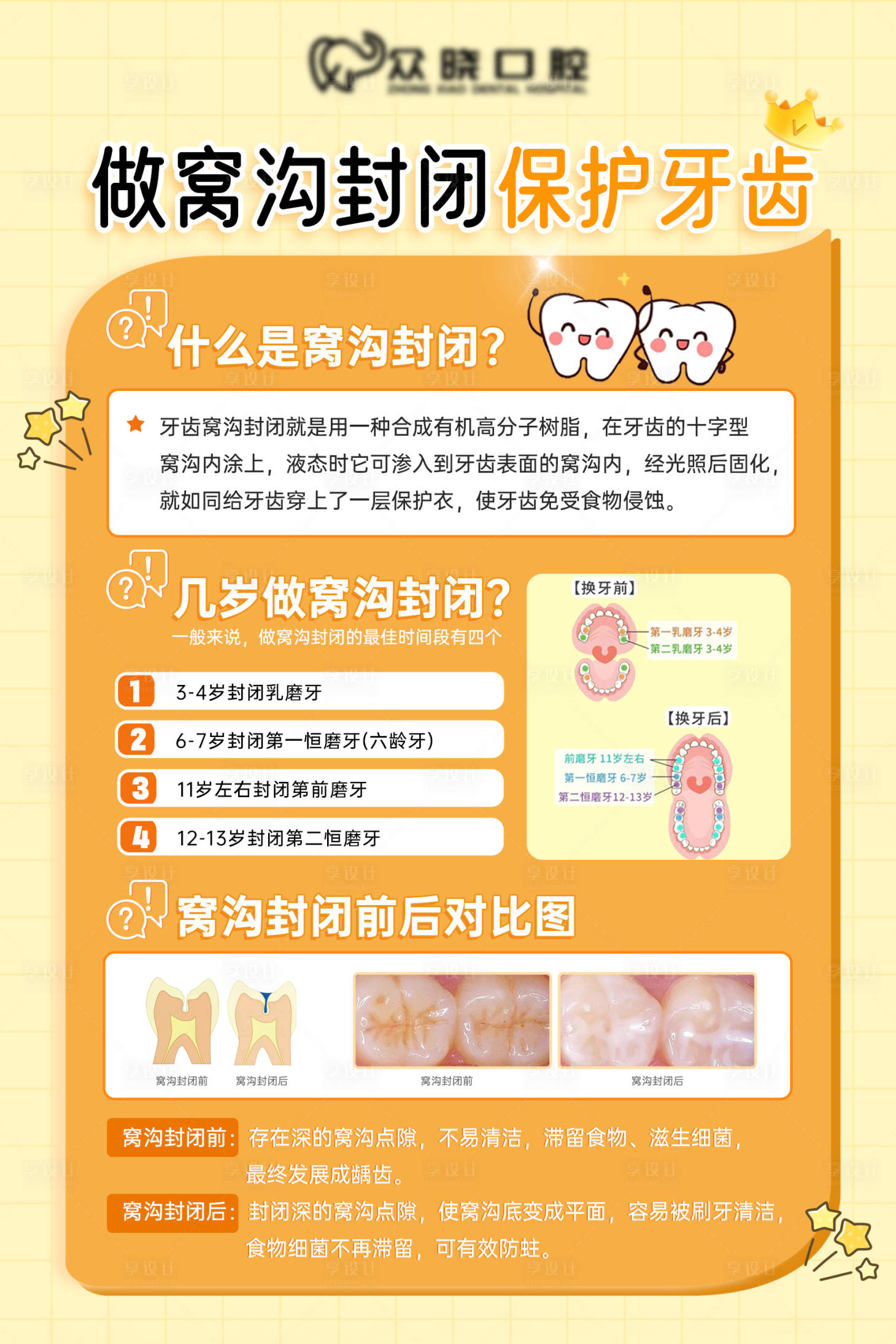 源文件下载【享设计】搜索编号：95060021171744645【窝沟封闭科普海报】