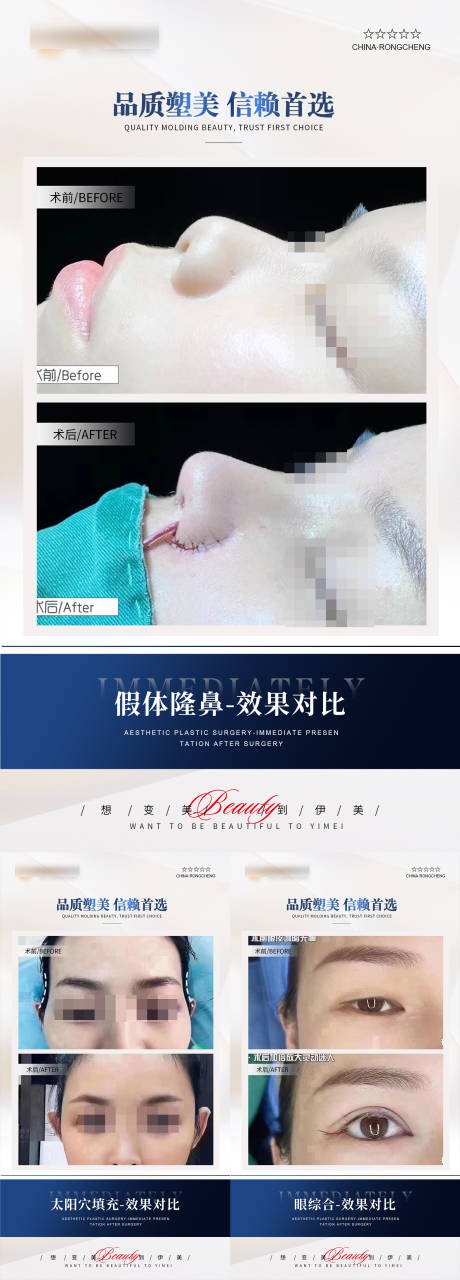 源文件下载【整形案例对比海报】编号：94700020875649954