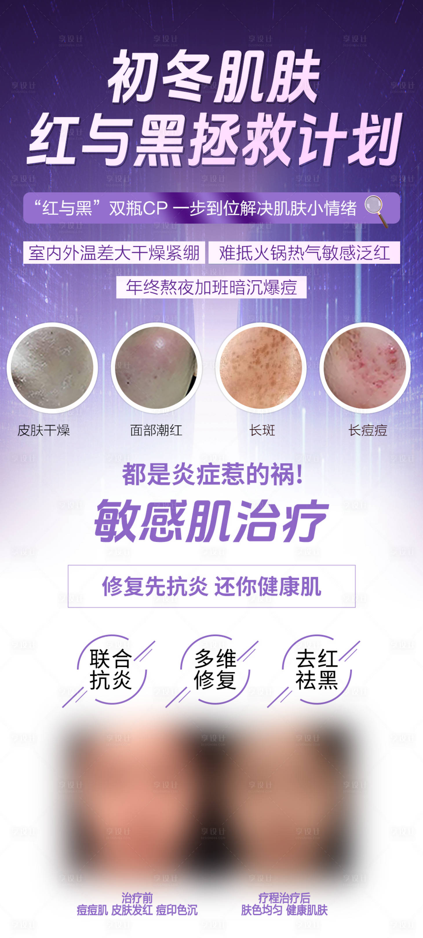 源文件下载【敏感肌好头疼】编号：11930020848983117