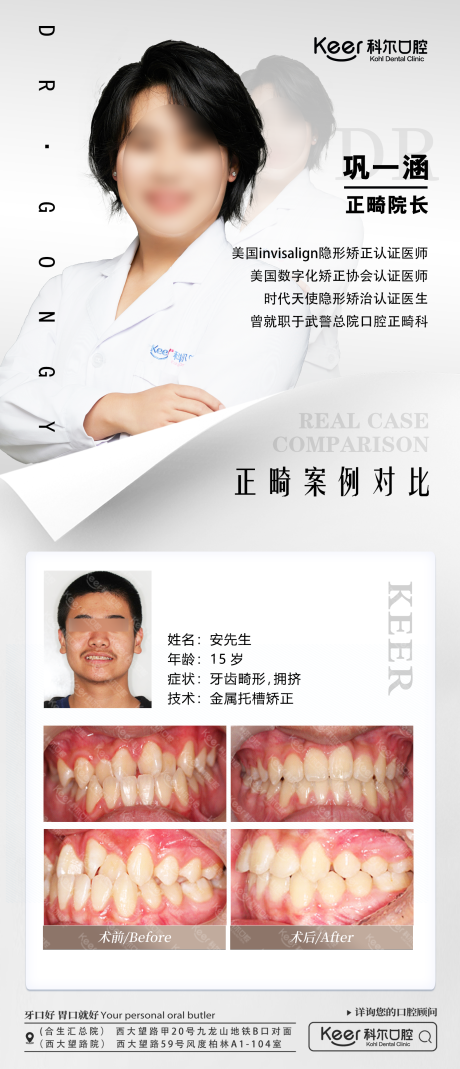 源文件下载【口腔案例对比海报】编号：50880021079977617
