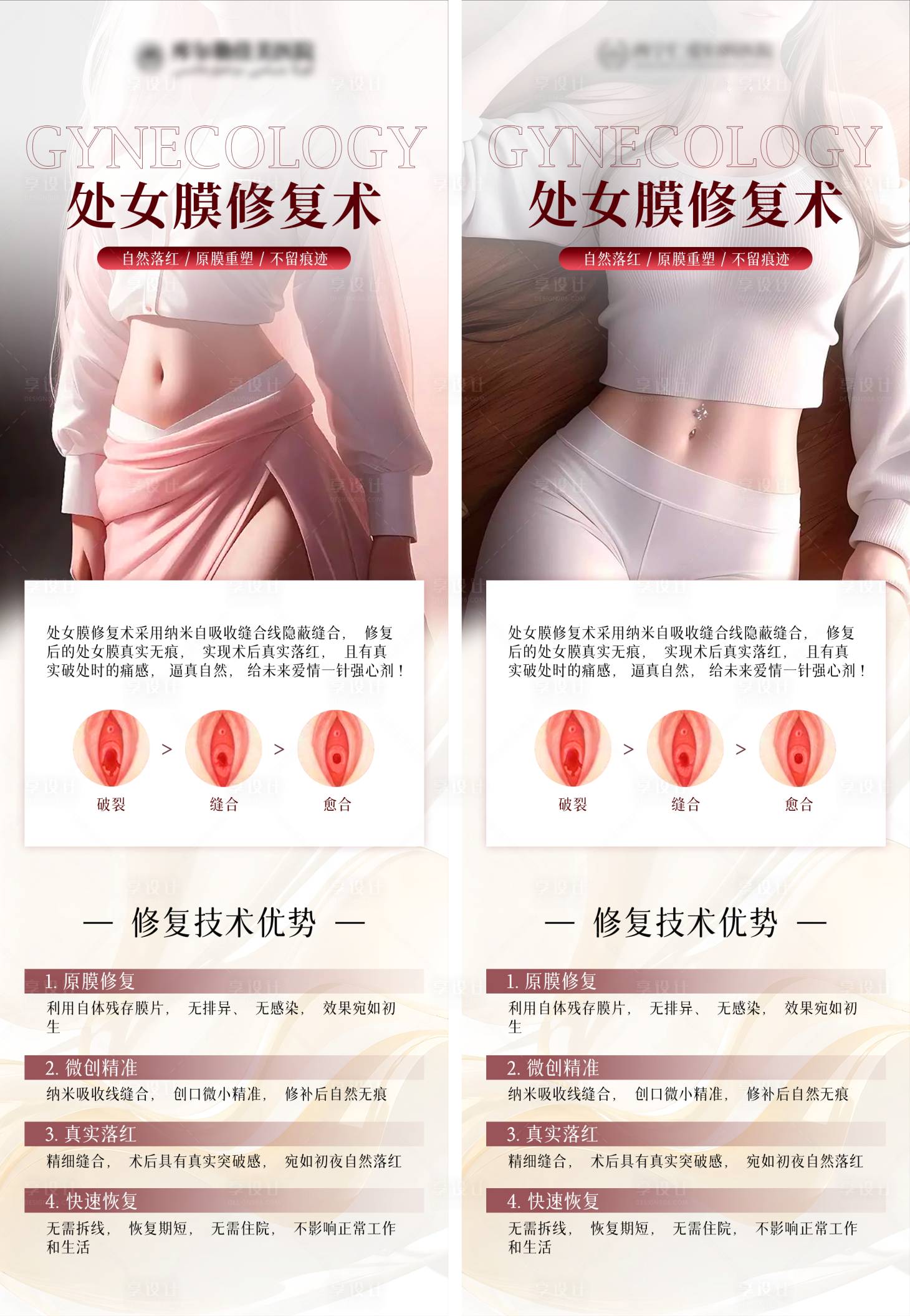 源文件下载【享设计】搜索编号：22830021091161878【处女膜修复优势】