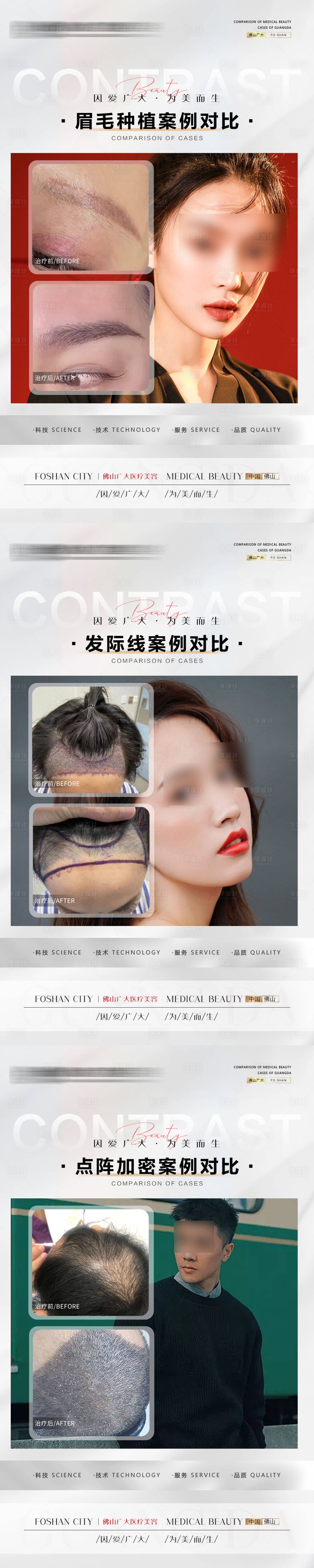 源文件下载【植发案例海报】编号：11860021157499856