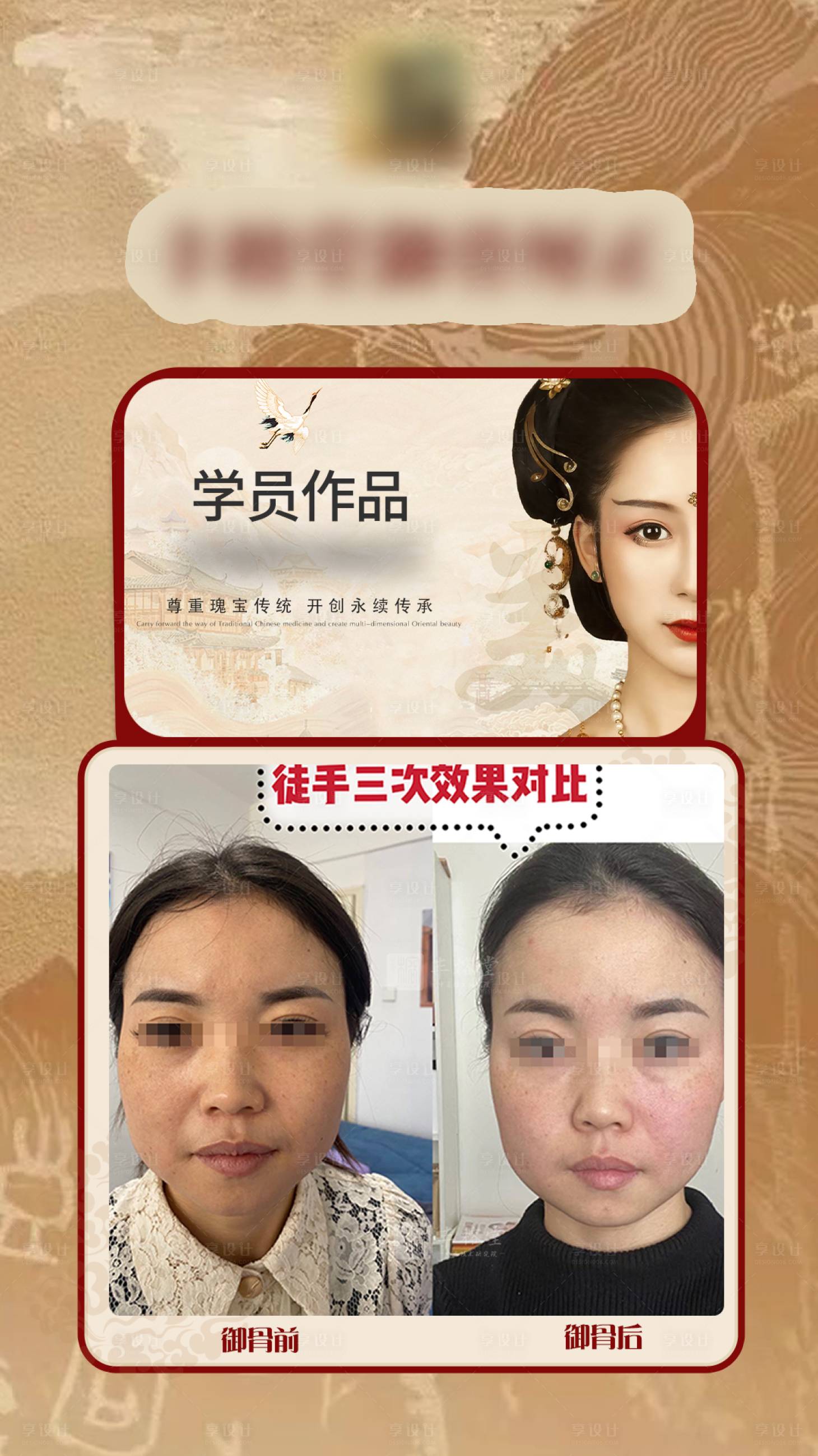 源文件下载【医美骨相美海报】编号：44950021105566791