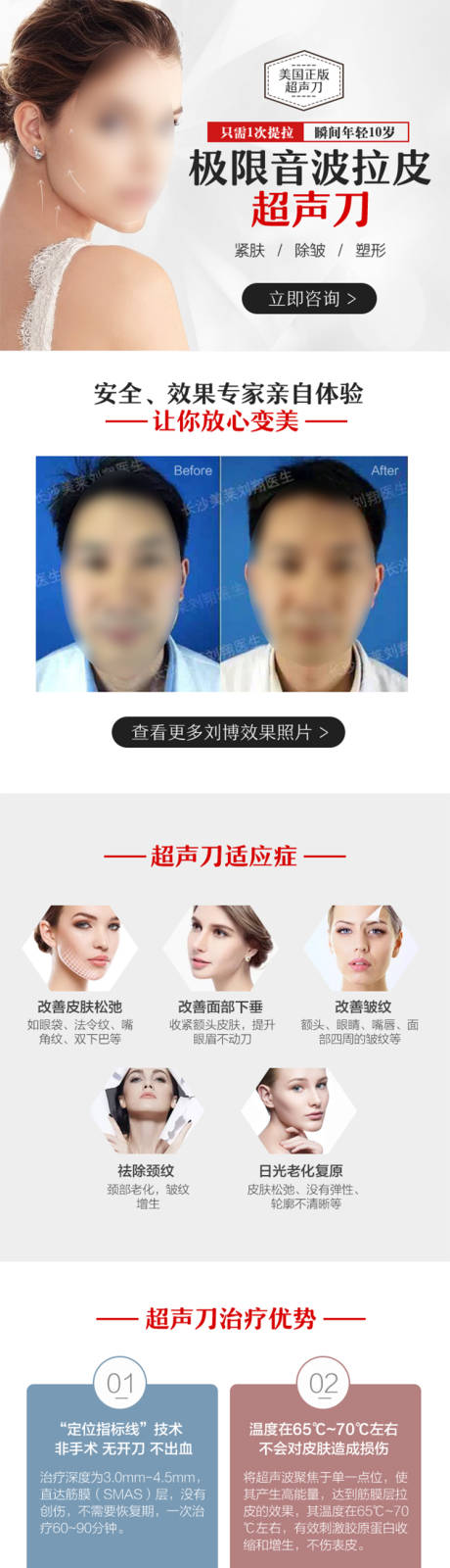 源文件下载【医美超声刀详情页】编号：82000020823868650