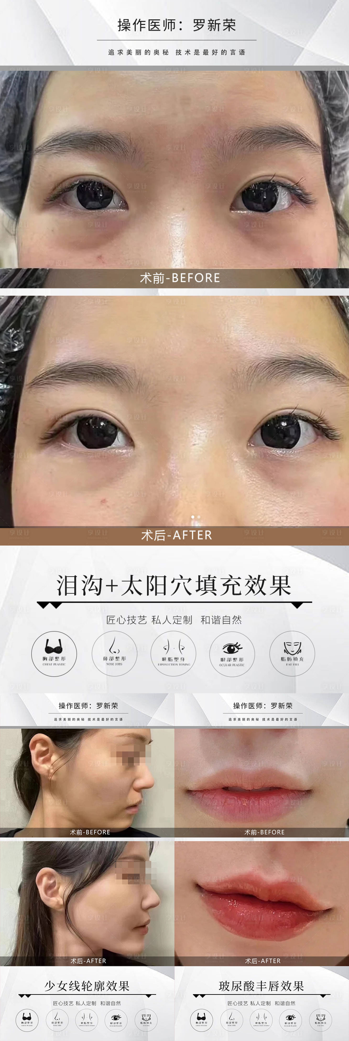 源文件下載【享設計】搜索編號：75370021249705487【整形美容案例】