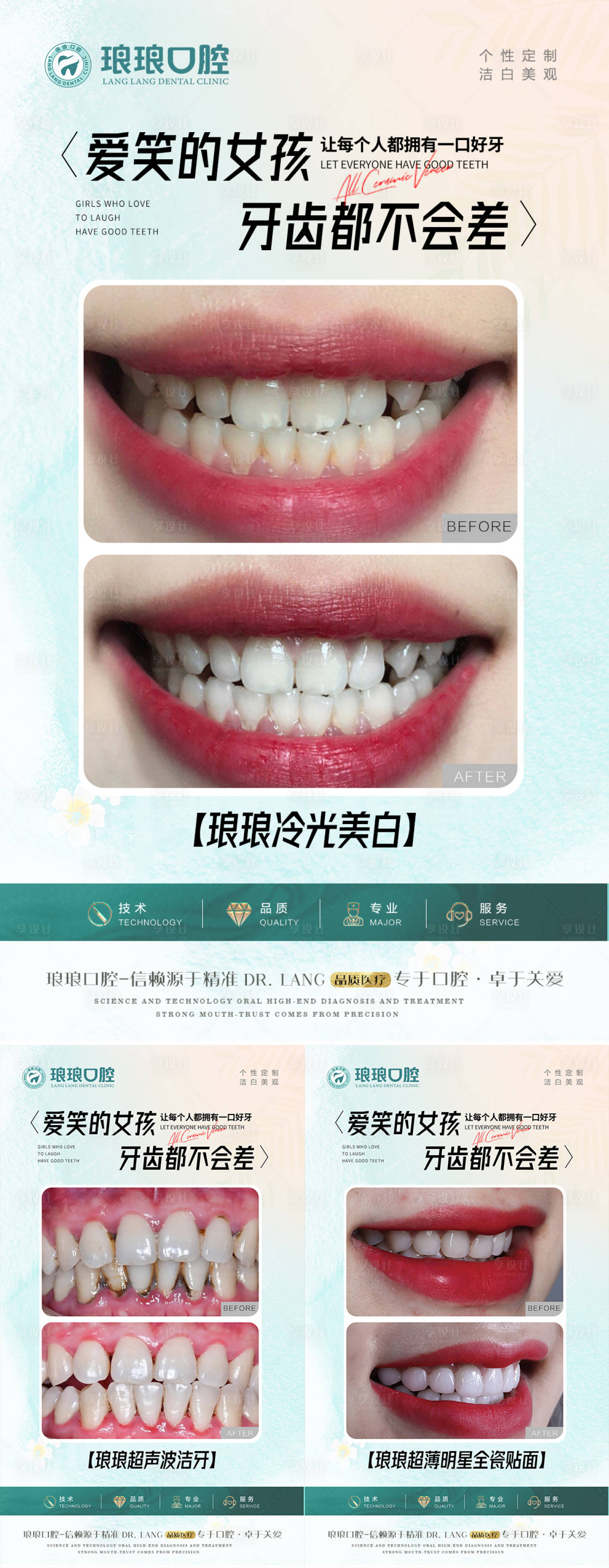 源文件下载【牙齿贴面超声波洁牙冷光美白案例海报】编号：68640021207626414